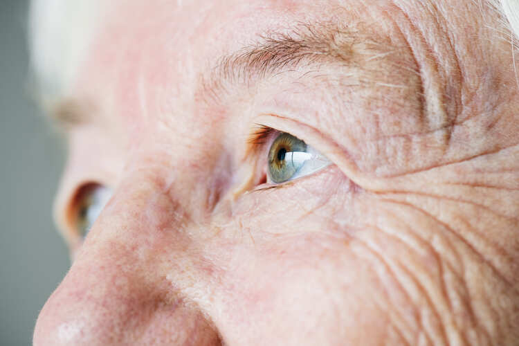 ojo de paciente con edema macular diabético