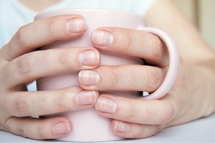 Causas de manchas blancas en las uñas