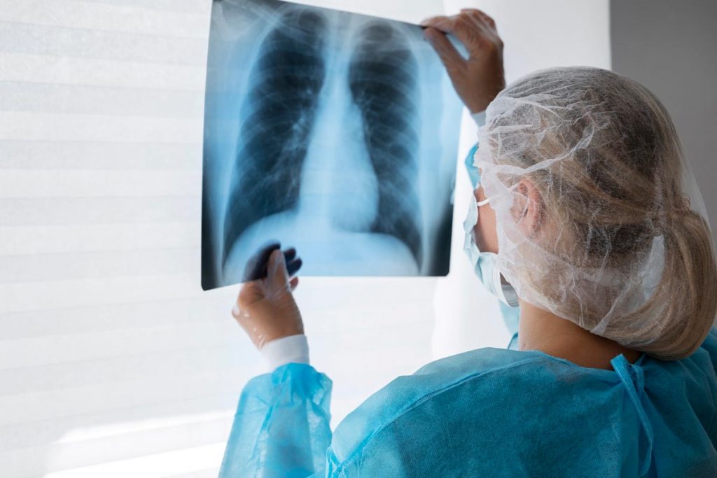 Investigación en cáncer de pulmón