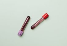 La EMA acerca a los pacientes una nueva combinación de TECVAYLI y daratumumab para mieloma múltiple