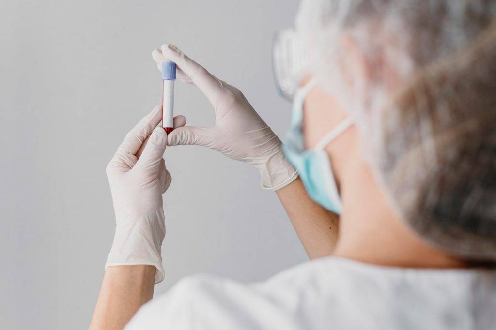 Prueba de diagnóstico en sangre.