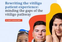 Vitíligo, el retraso en el diagnóstico puede alcanzar el año Vitiligo_Diagnostico